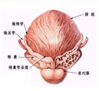 前列腺腫痛