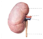 輸尿管結(jié)石
